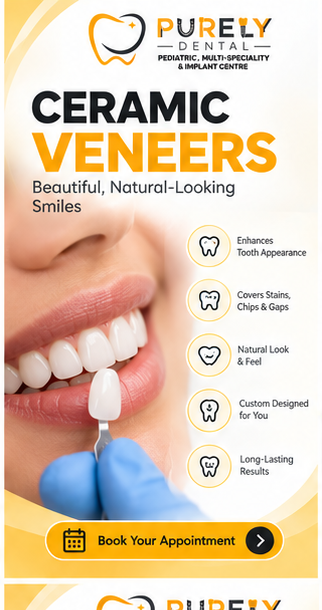 CERAMIC CVENEERS